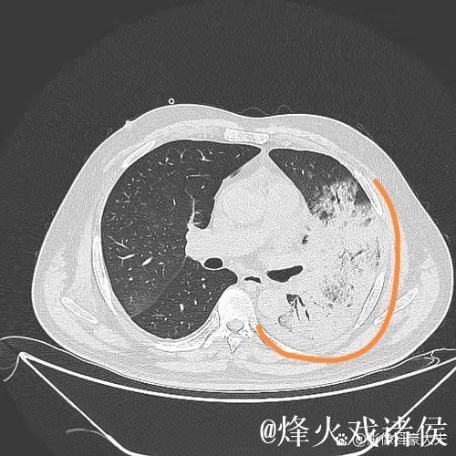 埃迪-豪:得肺炎住院后,意识到医疗体系与医护人员至关重要 埃迪-豪:得肺炎住院后,意识到医疗体系与医护人员至关重要