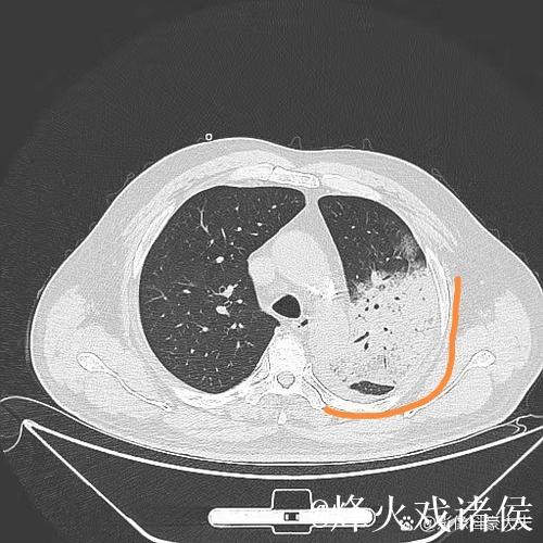 埃迪-豪:得肺炎住院后,意识到医疗体系与医护人员至关重要 埃迪-豪:得肺炎住院后,意识到医疗体系与医护人员至关重要